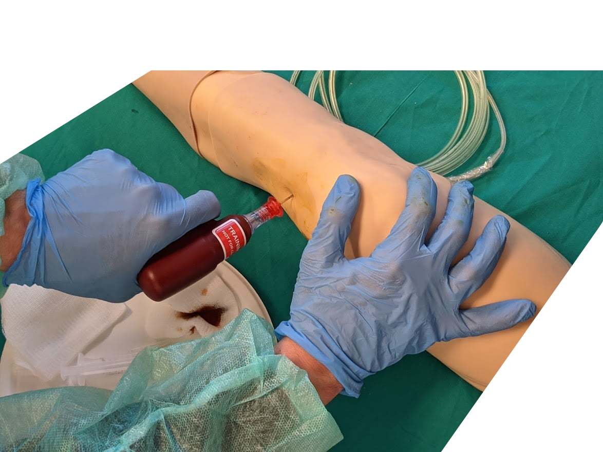 ACCESSO VASCOLARE IN EMERGENZA, INTRAOSSEA EZ-IO. PEDIATRICO E ADULTO