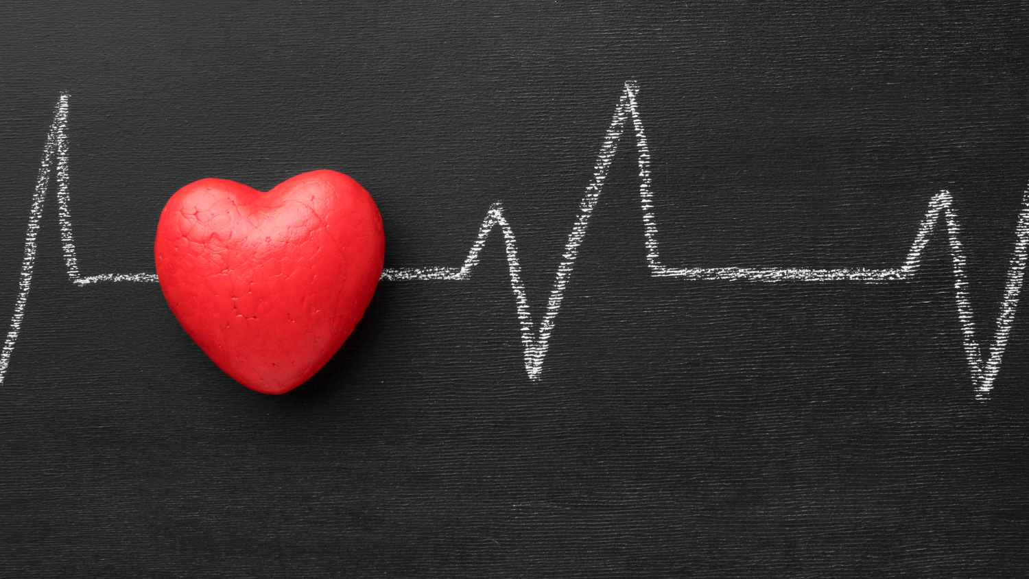 ESECUZIONE E INTERPRETAZIONE DELL' ECG NELLE ARITMIE E NELLE SINDROMI CORONARICHE ACUTE E LA PREVENZIONE CARDIOVASCOLARE