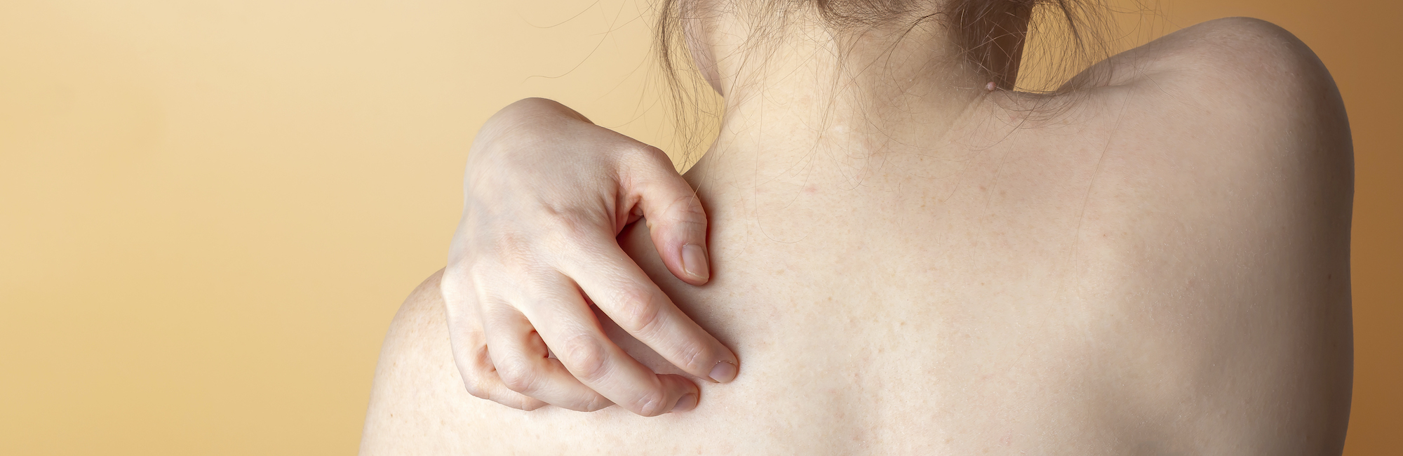 FIBROMIALGIA: APPROCCIO MULTIDISCIPLINARE